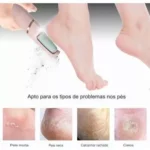 Lixador de Pé Elétrico Esfoliador Tira Calos Pedicure4